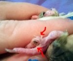 bum-foot.jpg